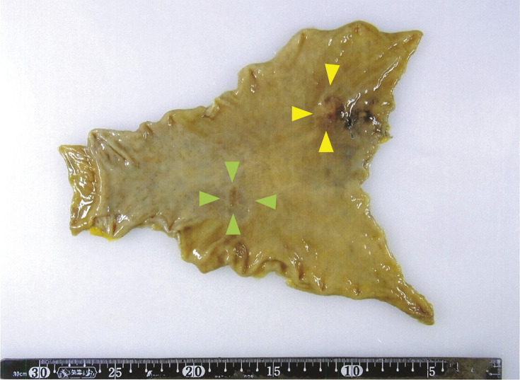 Fig. 3