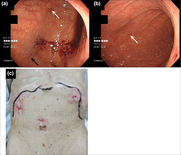 FIGURE 3