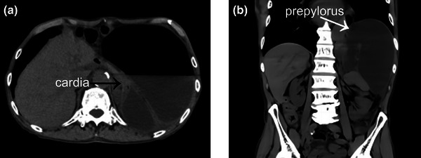 FIGURE 1