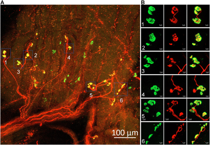 FIGURE 3