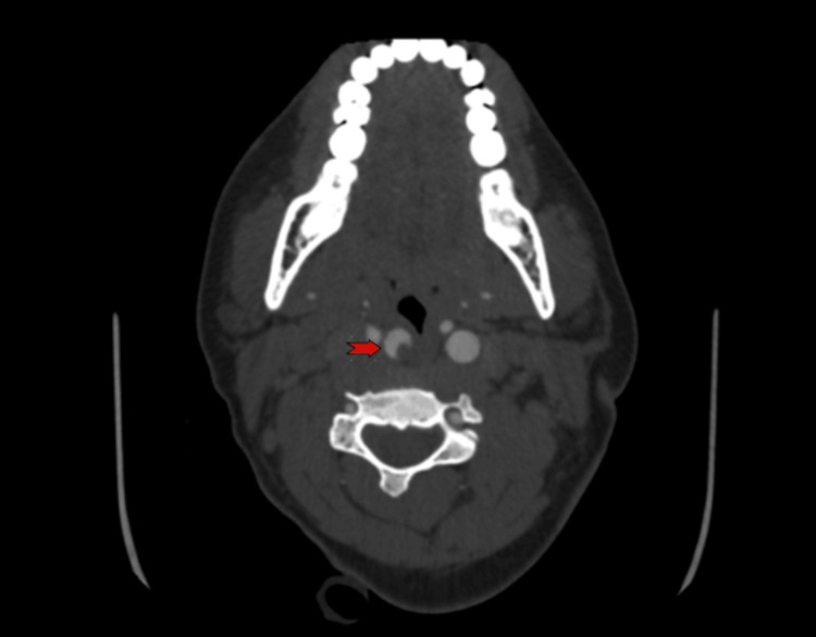 Figure 6