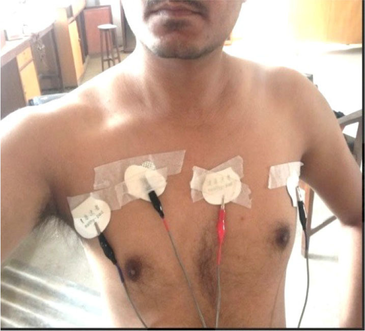 Fig. 4