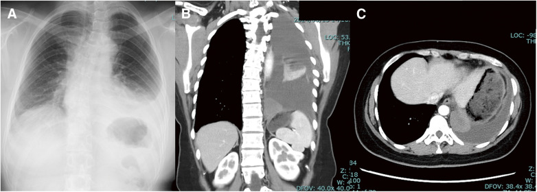 Fig. 1