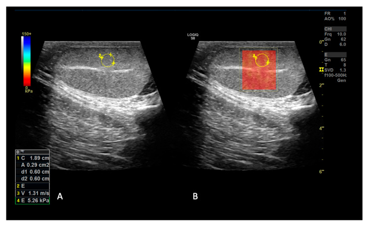 Figure 4