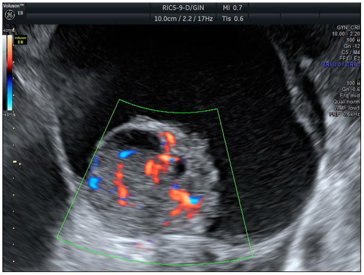 Figure 2