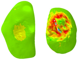 Figure 11