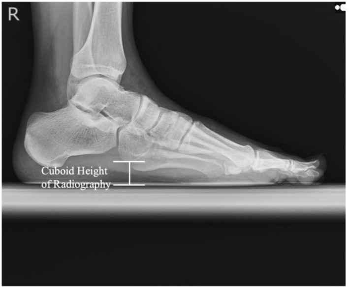 FIGURE 1