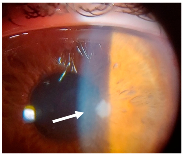 Figure 13