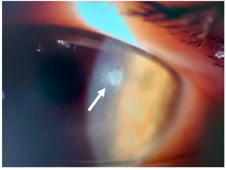 Figure 15