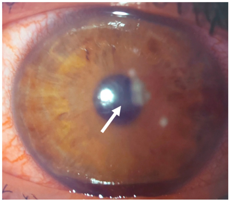 Figure 18