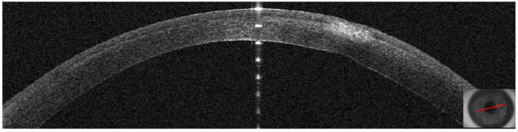 Figure 19