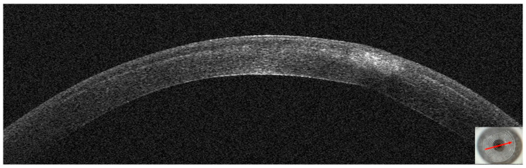 Figure 20