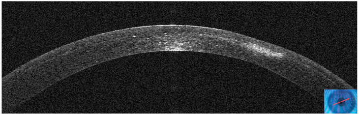 Figure 21
