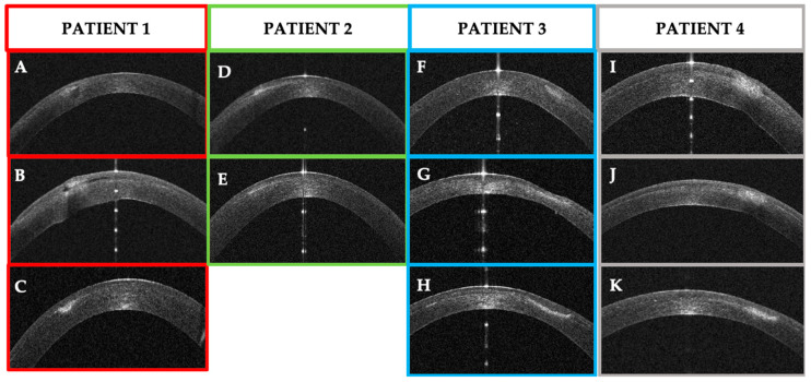 Figure 22