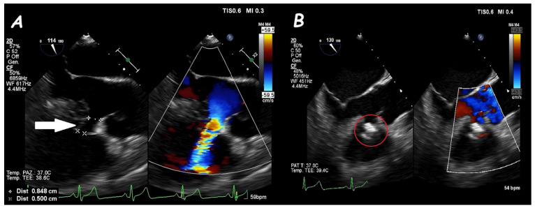 Figure 13