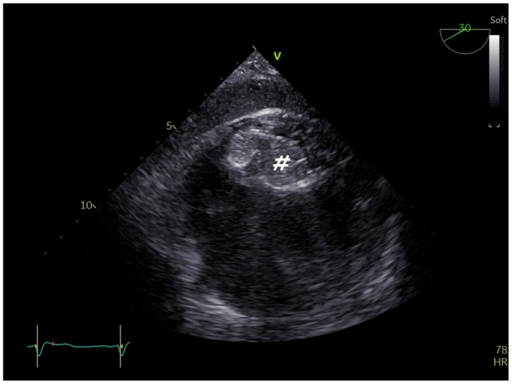 Figure 15