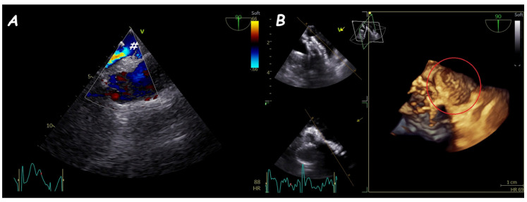 Figure 16