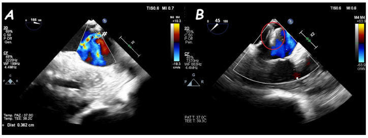 Figure 17
