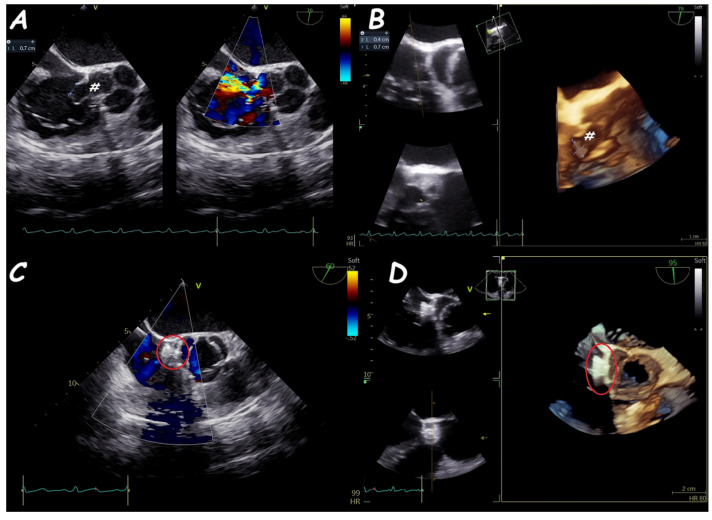 Figure 18
