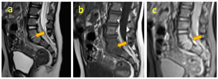 Figure 13
