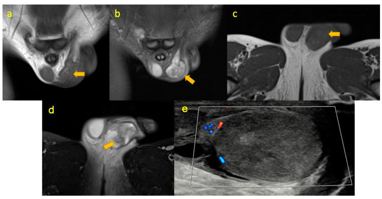 Figure 16