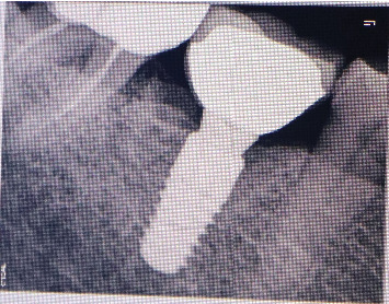 Figure 19