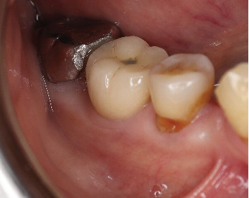 Figure 20