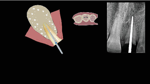 Figure 25
