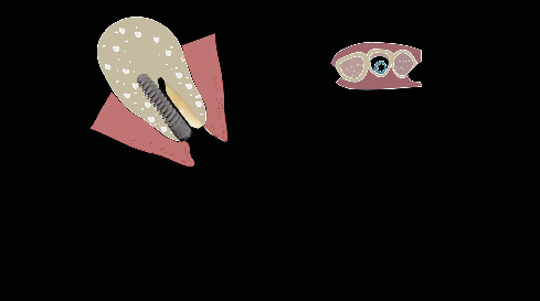 Figure 30