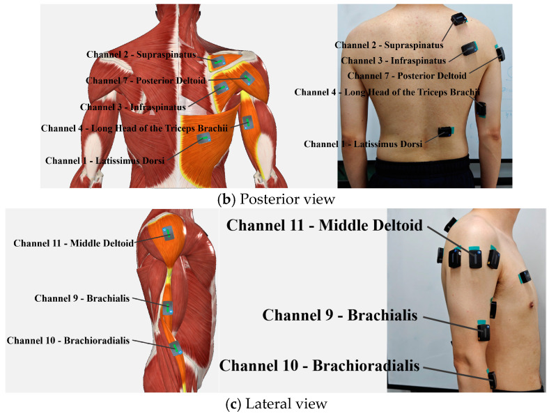 Figure 12