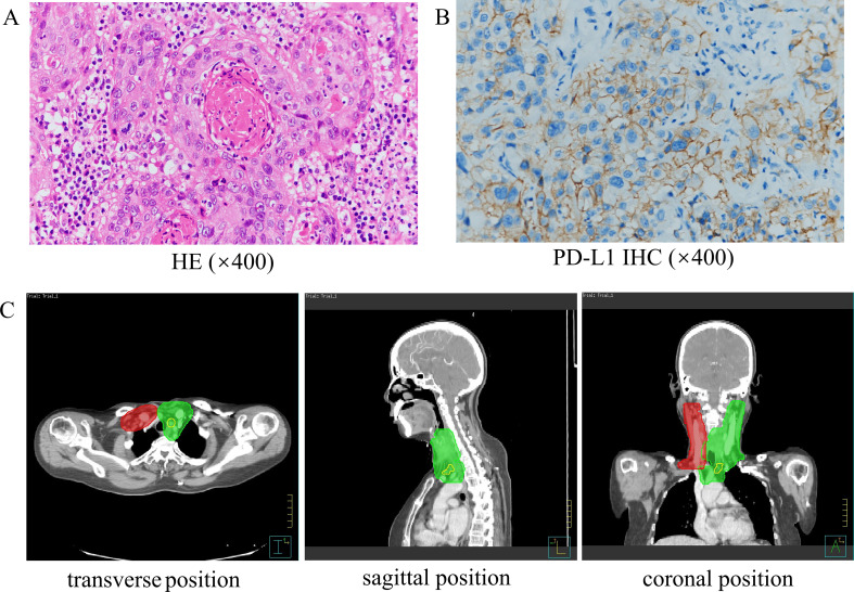 Figure 1