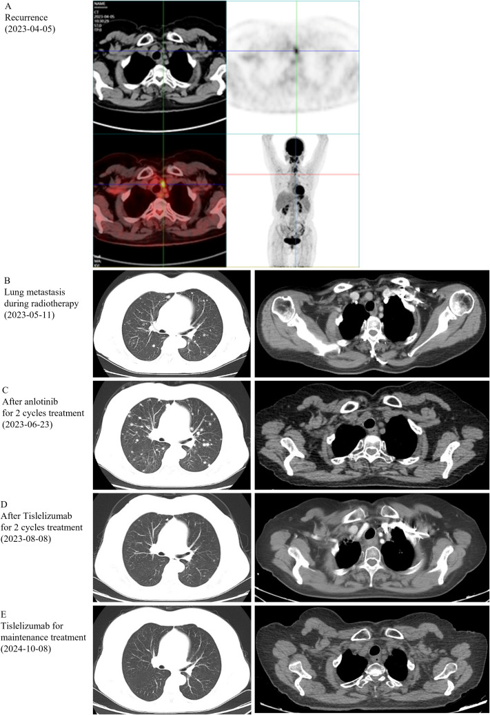 Figure 2