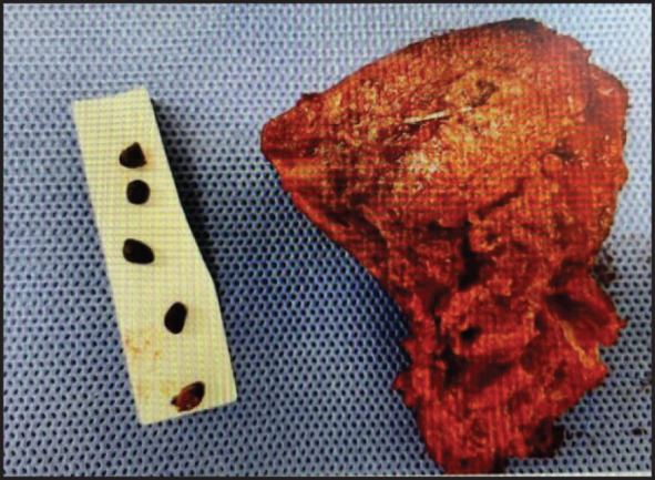Fig. 5