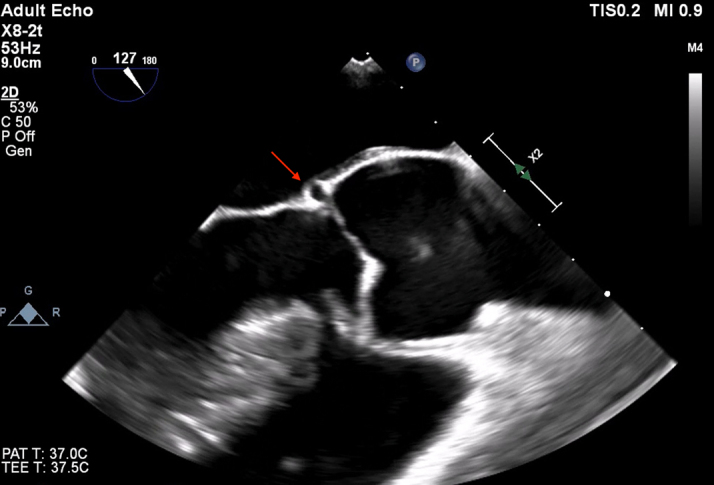 Figure 5
