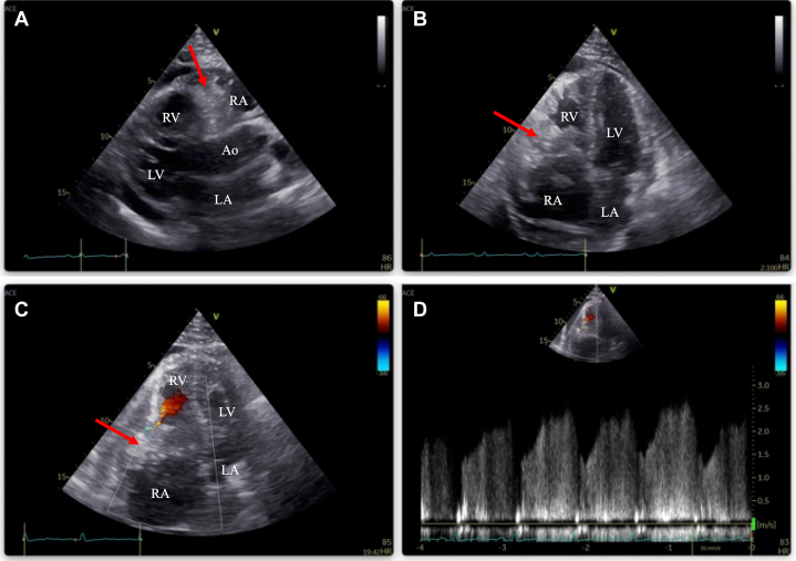 Figure 4