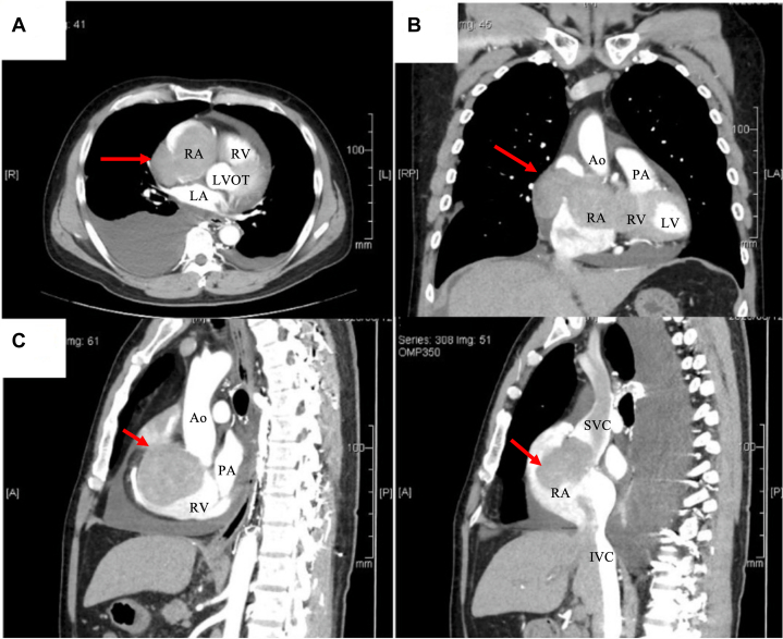 Figure 5