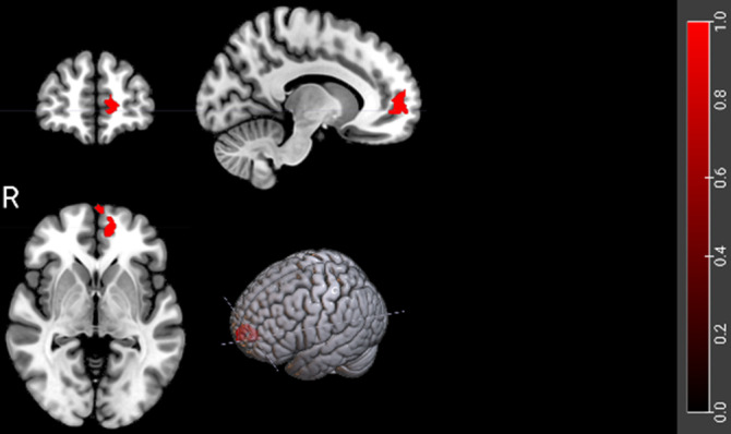 Figure 153