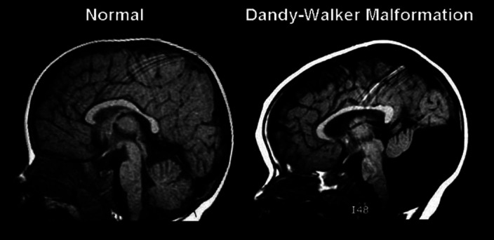 Figure 35