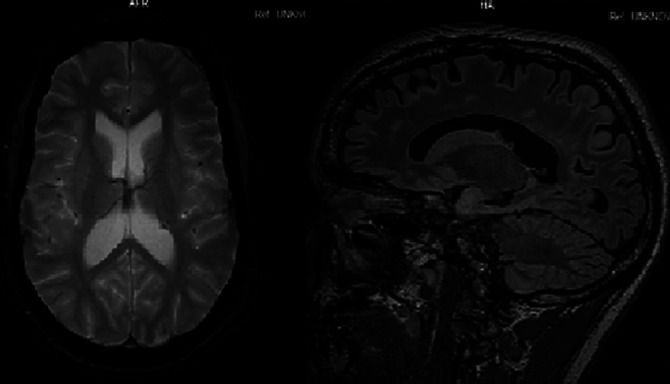 Figure 122