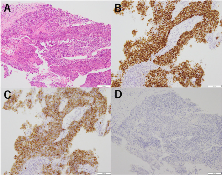 Figure 2