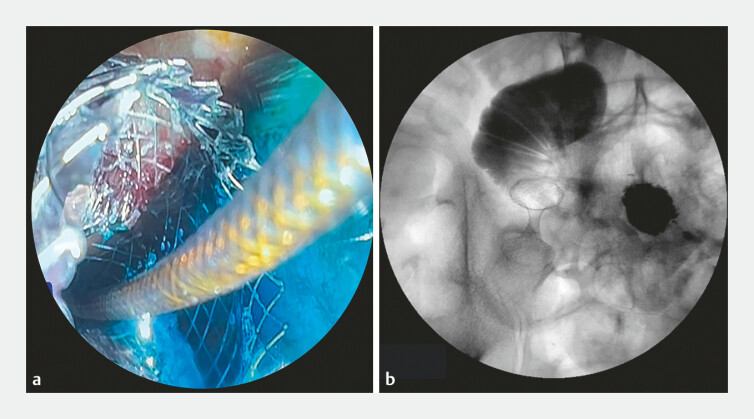 Fig. 3