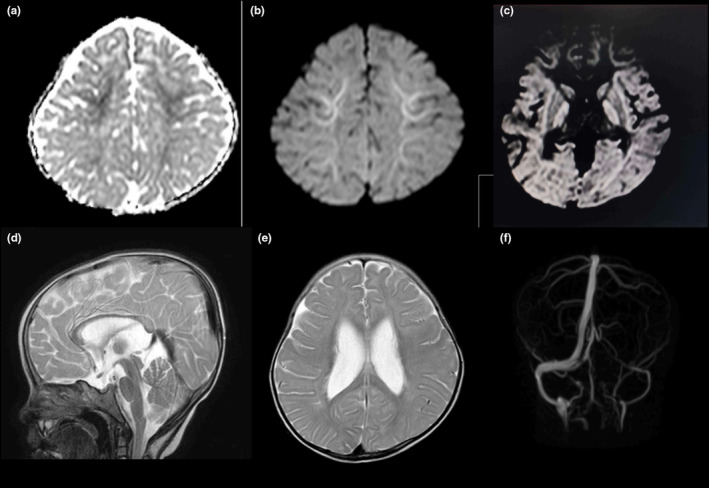 FIGURE 3