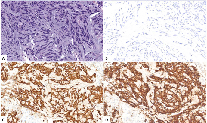 Figure 2