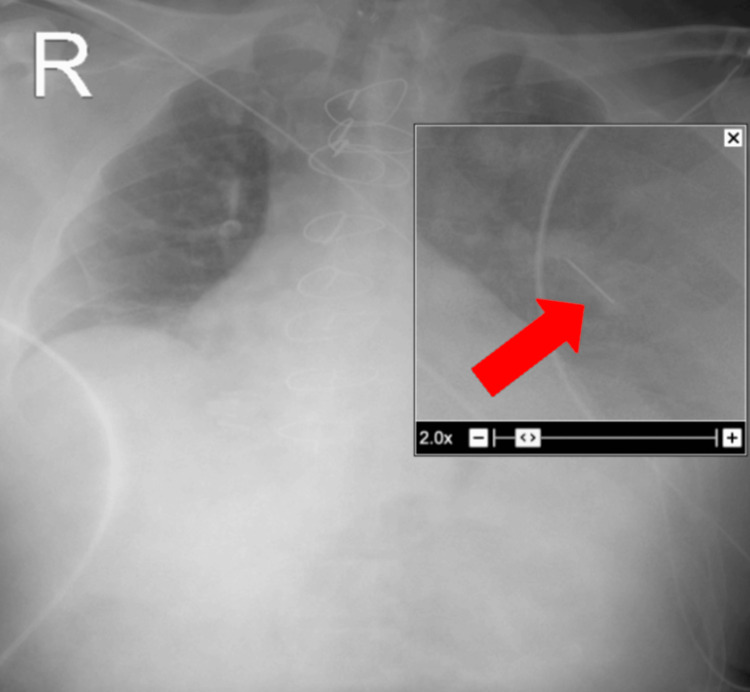 Figure 5
