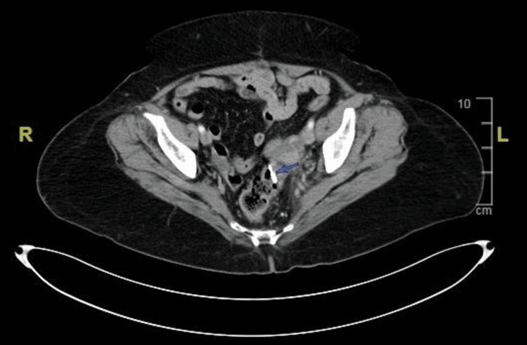 Figure 7