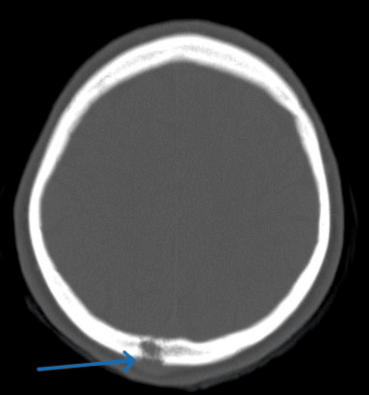Figure 5