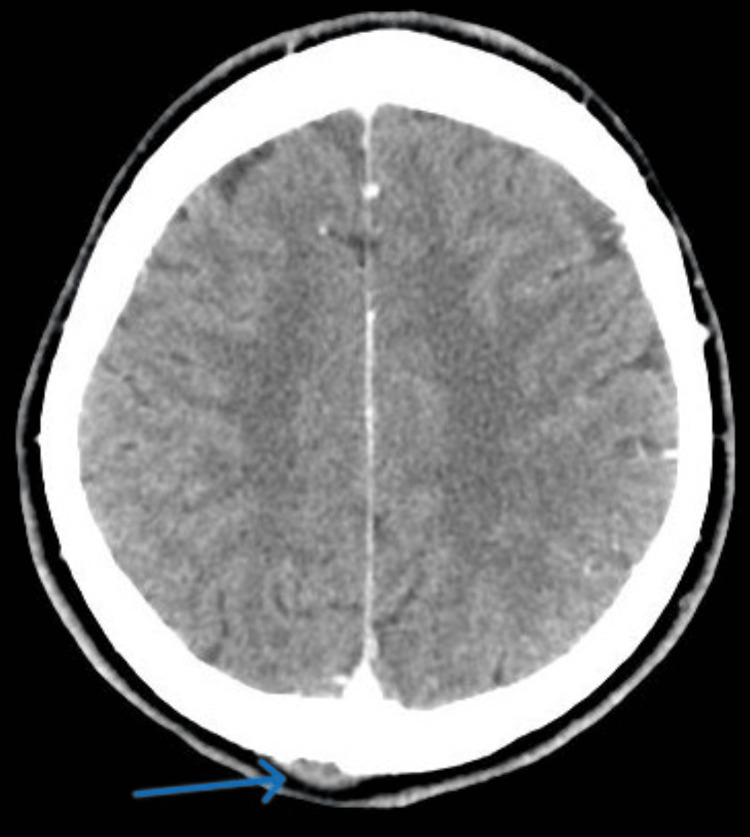 Figure 6
