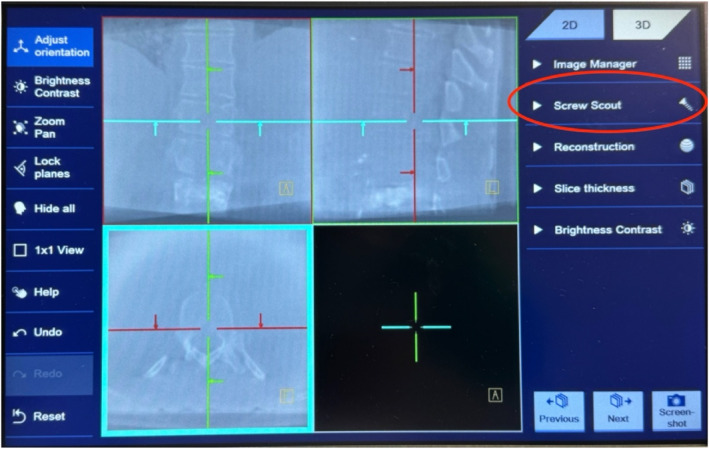 Figure 11