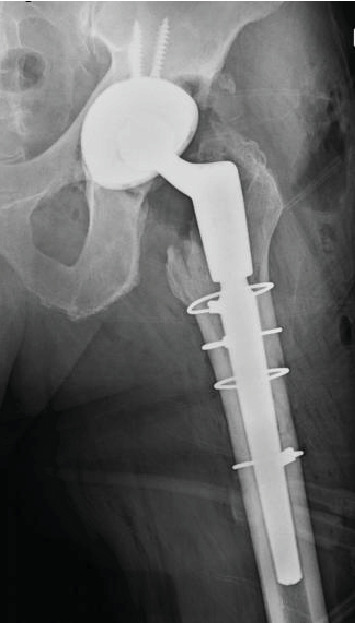 Figure 6