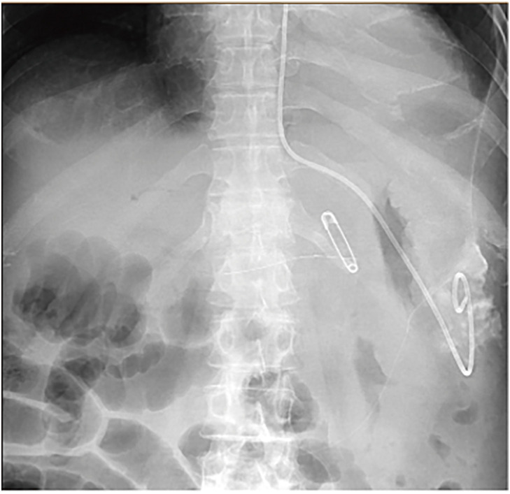 Fig. 4